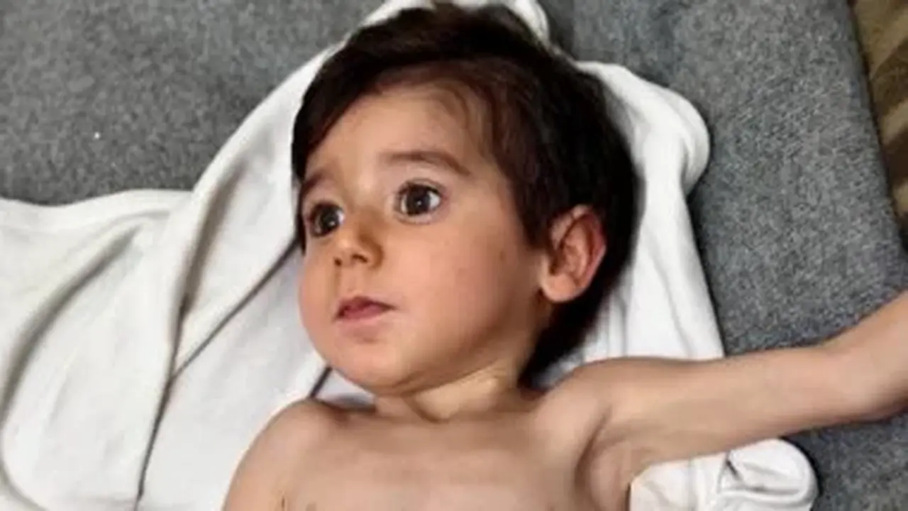 الطفل زين في غزة يعاني من سوء تغذية حاد يهدد حياته ويلقي الضوء على الأزمة الصحية المتفاقمة